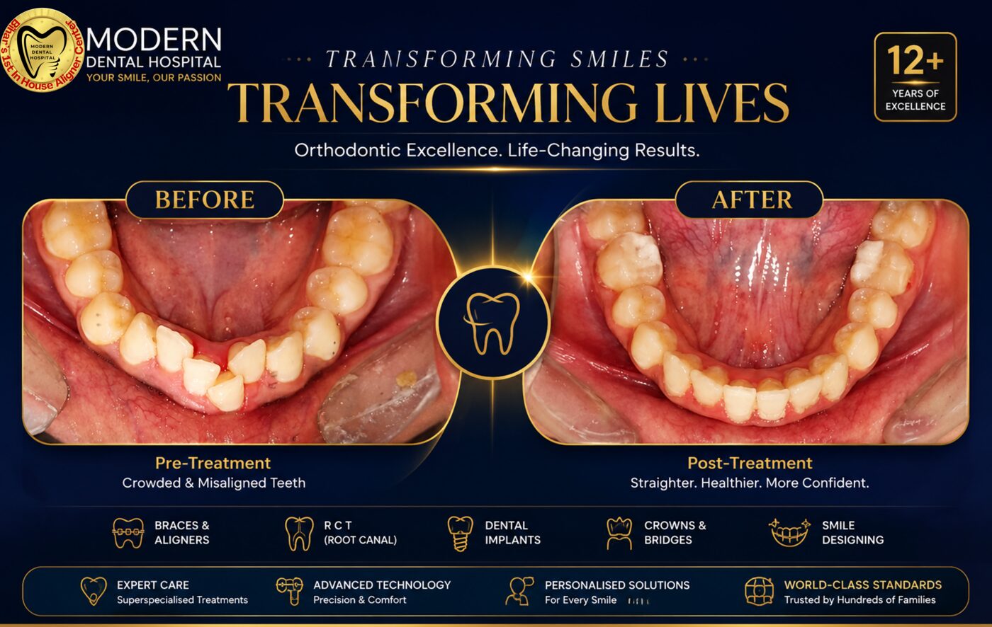 Real crowded teeth orthodontic transformation before and after Patna